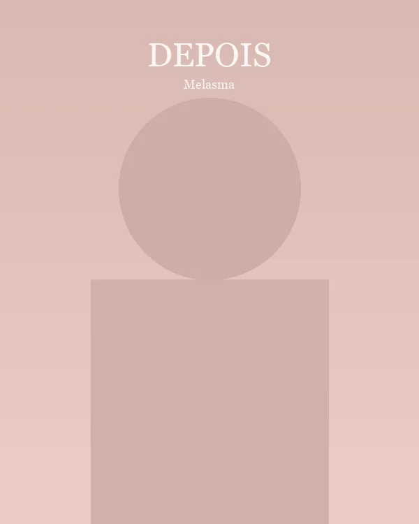 Depois tratamento melasma resultado