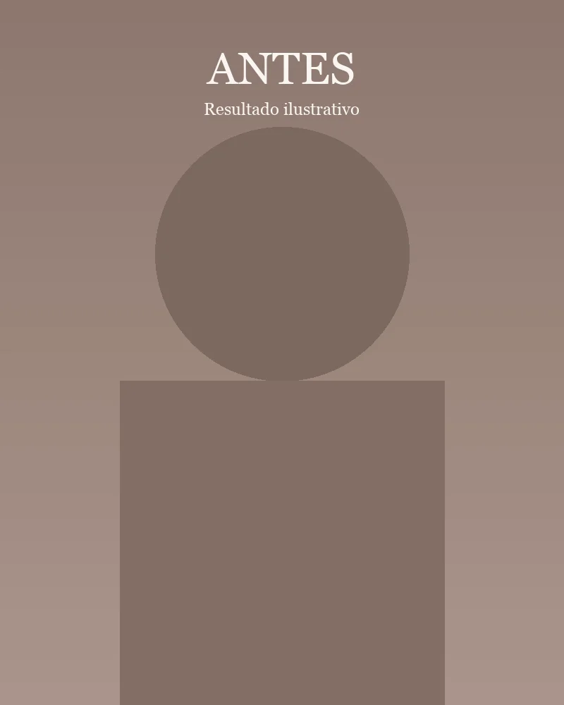 Antes tratamento de pele dermatologista Ponte Nova